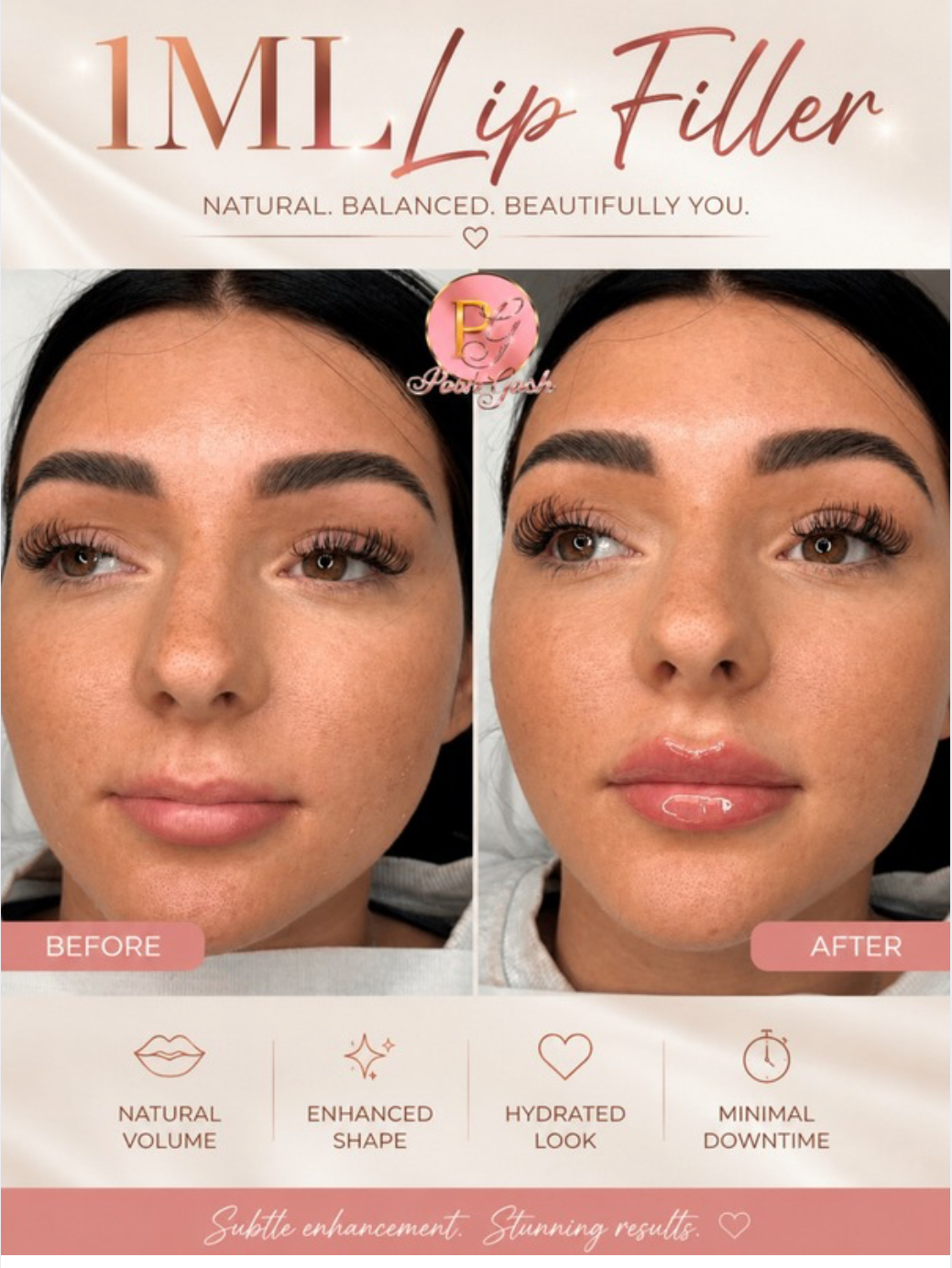 Posh Gosh lip filler before and after — Enhanced Shape · Hydrated Finish